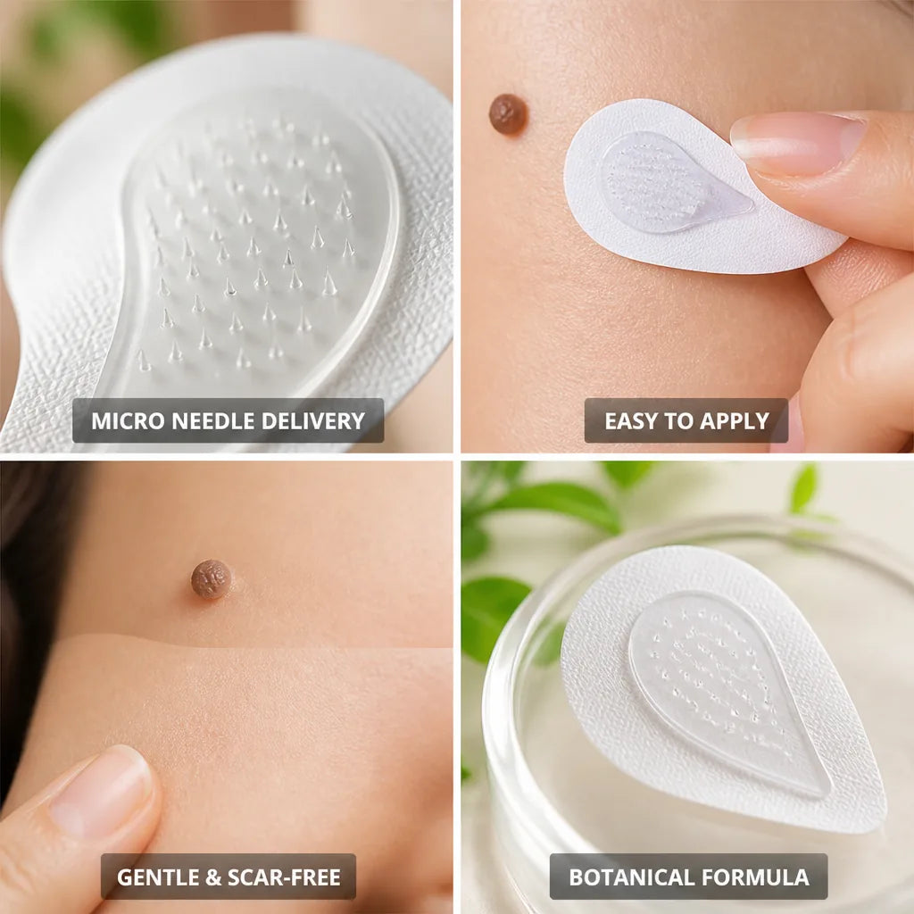 Skin Tag Removal Patch Microneedle Delivery Botanical Scar Free