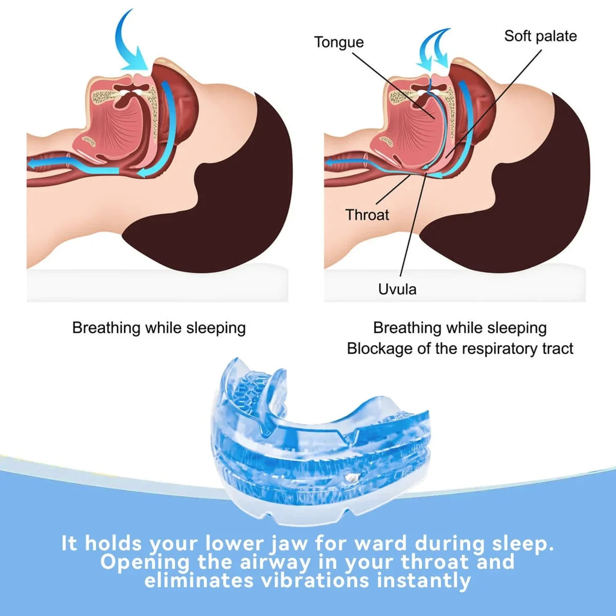 Anti-Snoring Mouthpiece Screw-Adjustable & Dual-Arch With Travel Case
