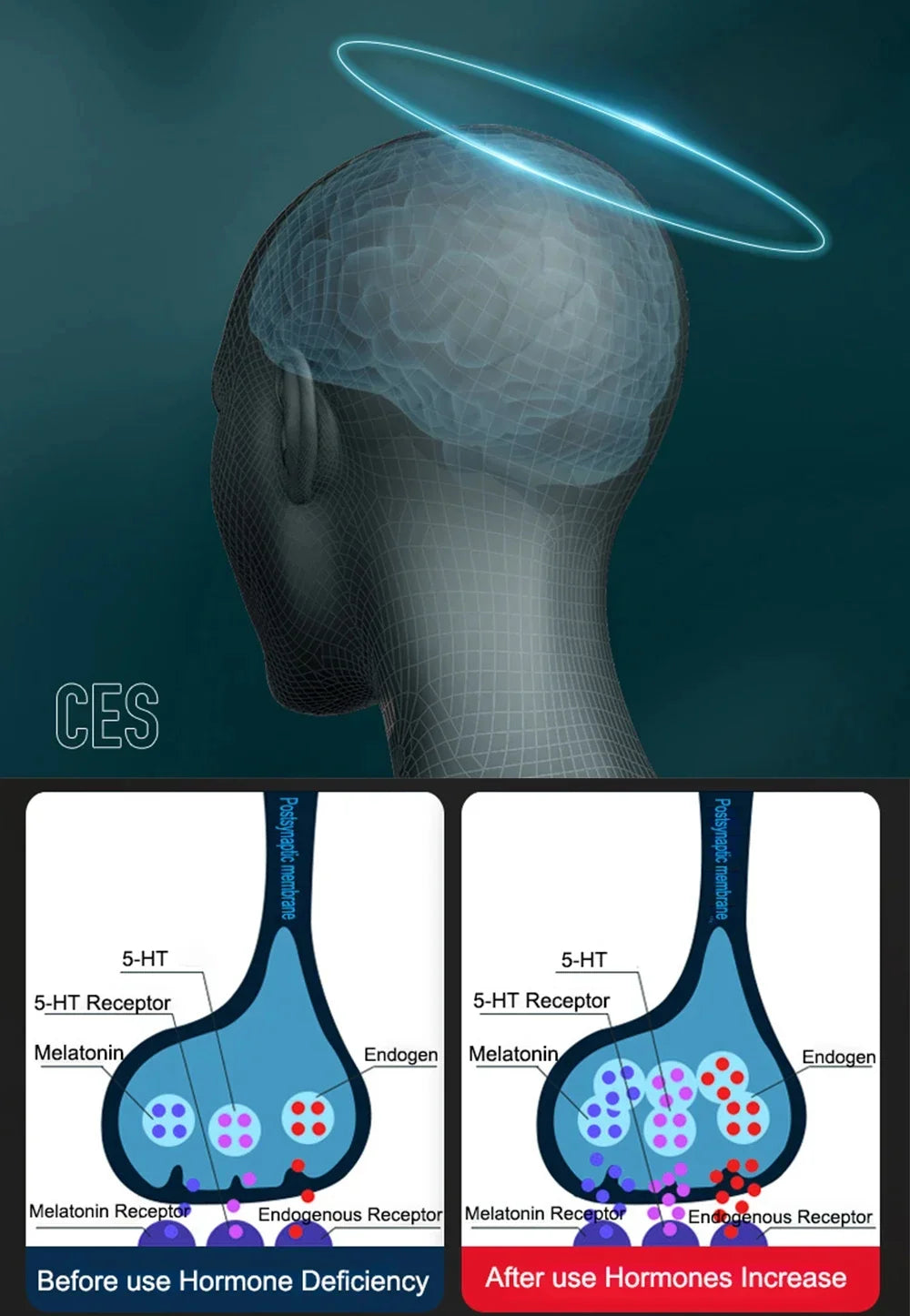 Ear Clip Stimulator Battery-Powered 30-Minute Timer