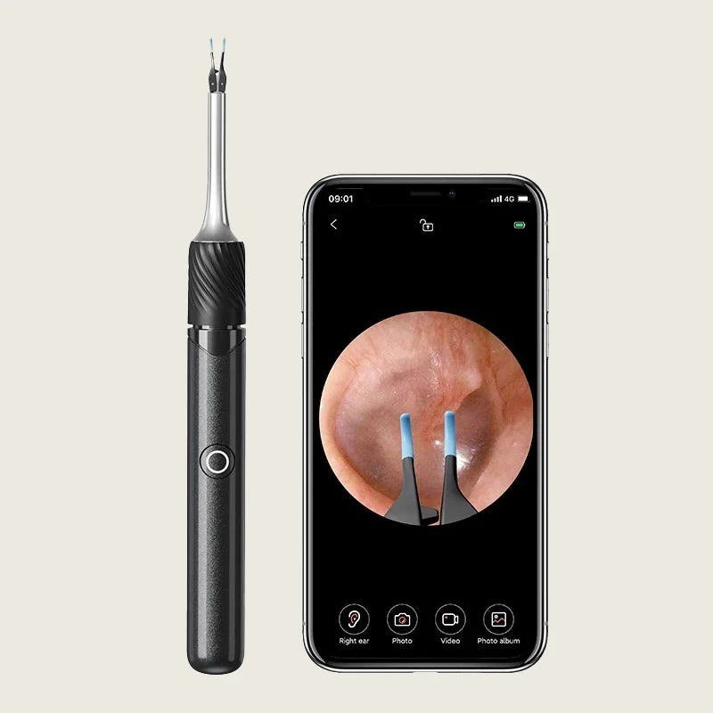 Ear Wax Removal Tool 12MP HD Wi‑Fi