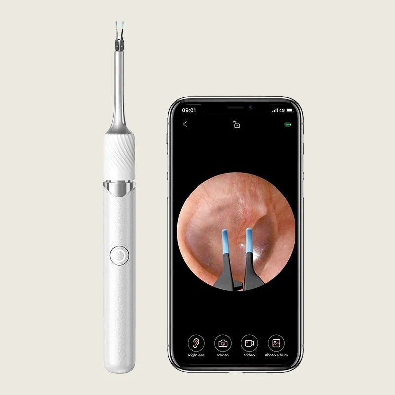 Ear Wax Removal Tool 12MP HD Wi‑Fi