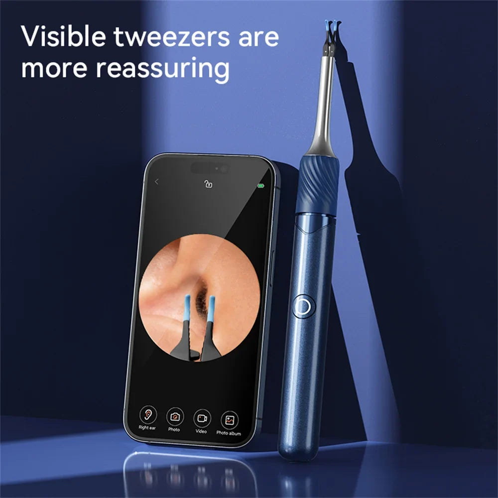 Ear Wax Removal Tool 12MP HD Wi‑Fi