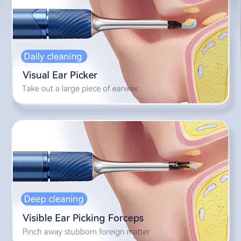 Ear Wax Removal Tool 12MP HD Wi‑Fi