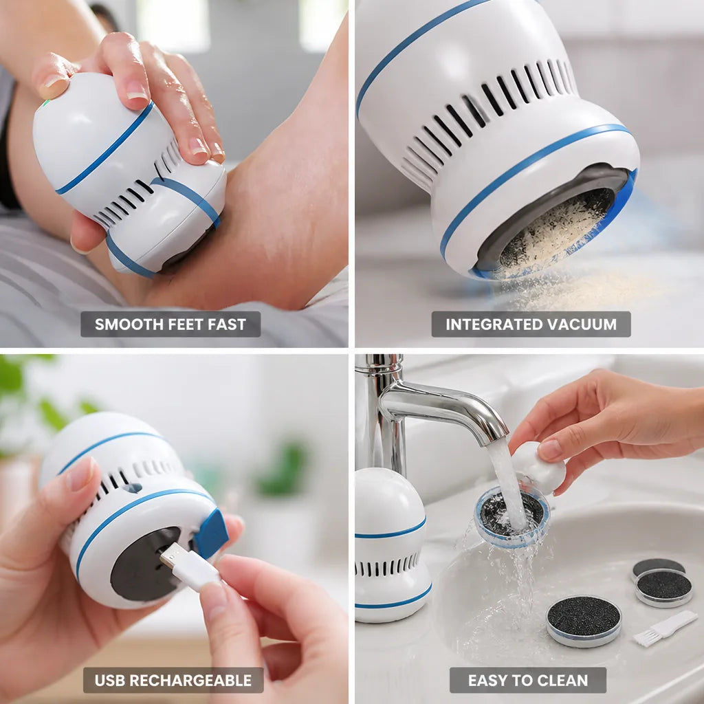 Electric Callus Remover Micro-Abrasion Integrated Vacuum USB Rechargeable