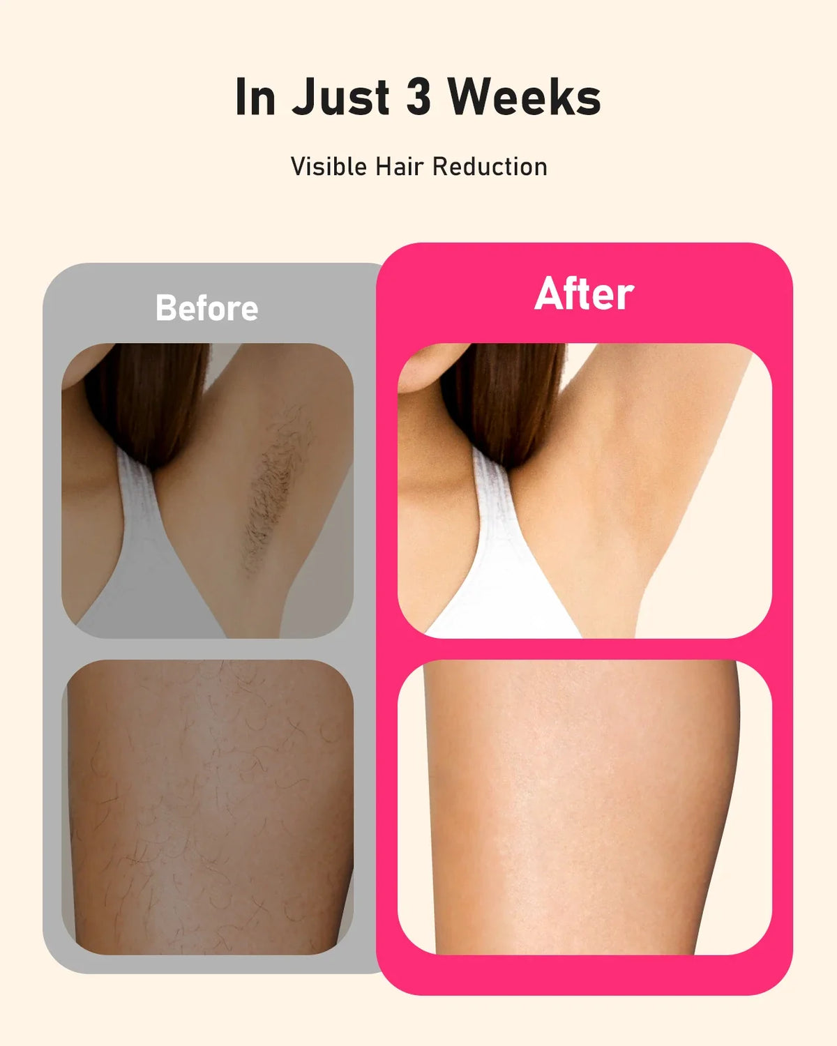 IPL Hair Removal Device 999,999 Flashes Auto & Manual