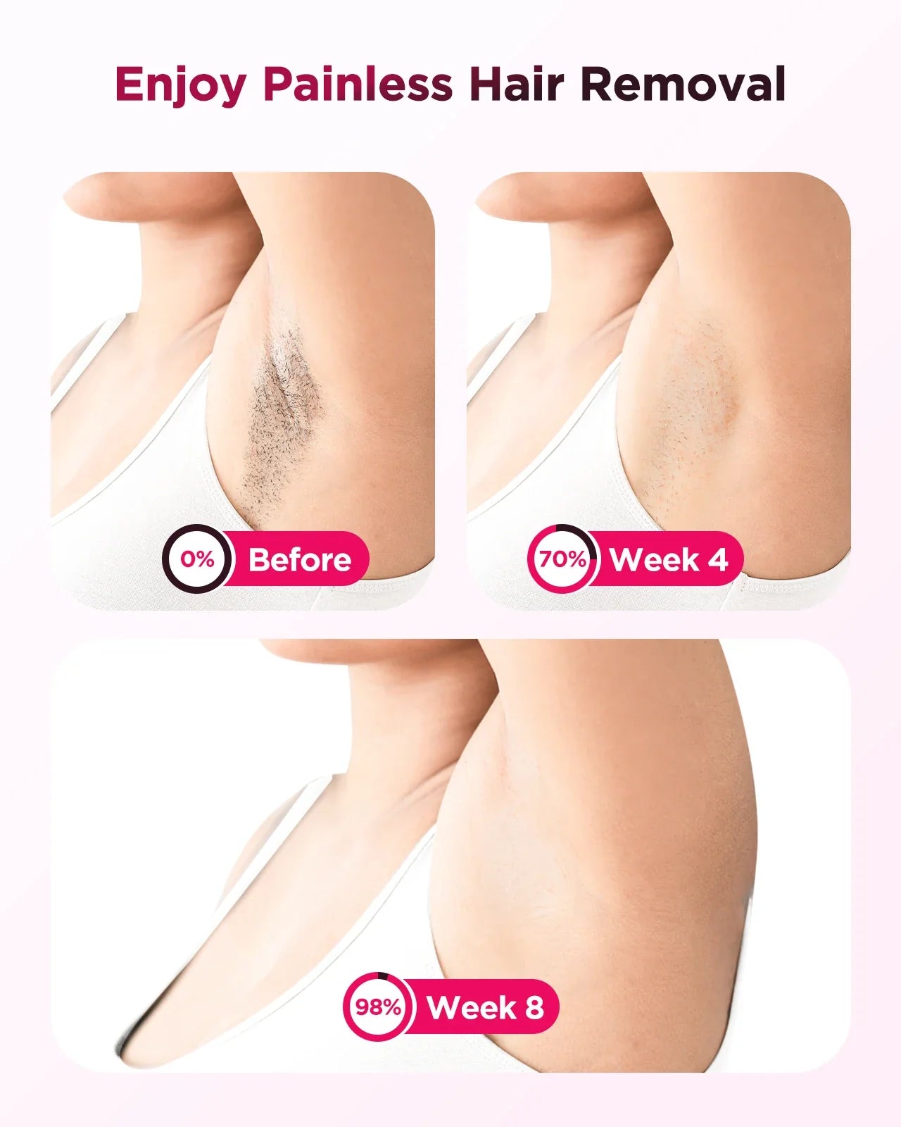 IPL Hair Removal Device Auto-Glide 999,900 Flashes