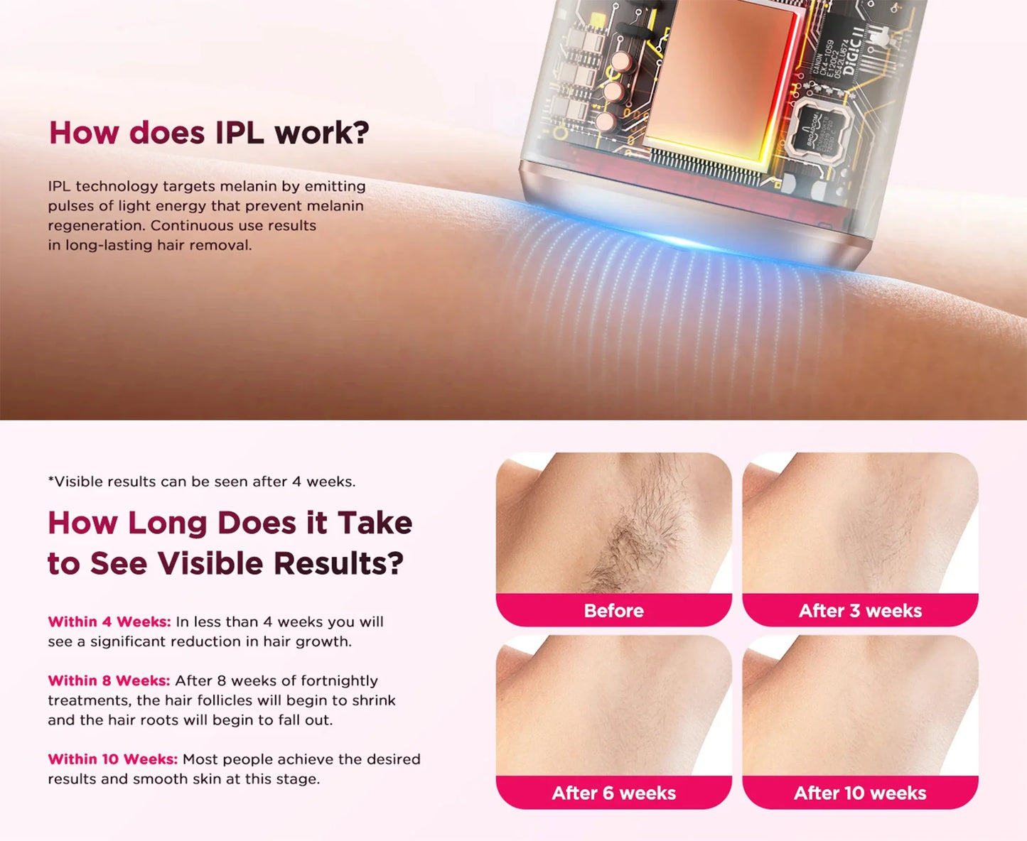 IPL Hair Removal Device Auto-Glide 999,900 Flashes