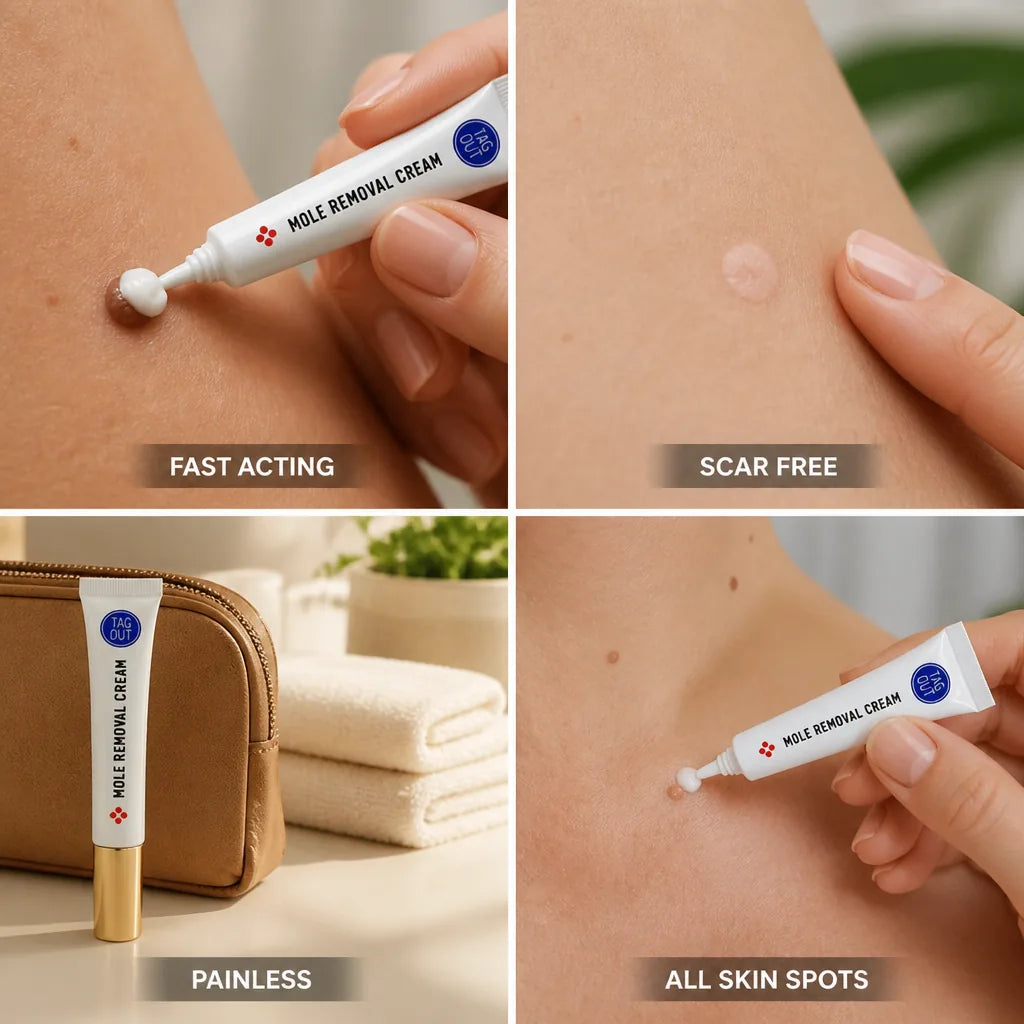 Mole Removal Cream Painless Scar Free Fast Acting