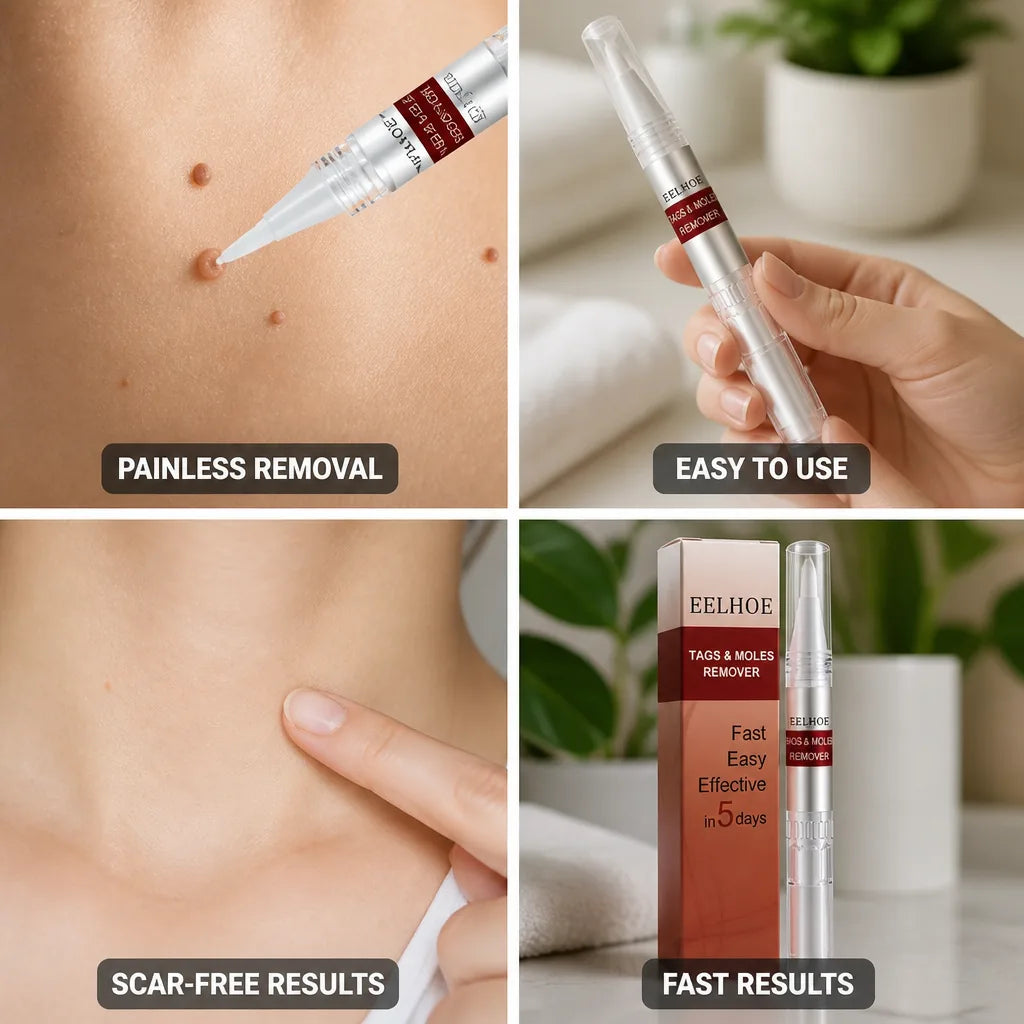 Skin Tag & Mole Remover Scar-Free Tea Tree Oil