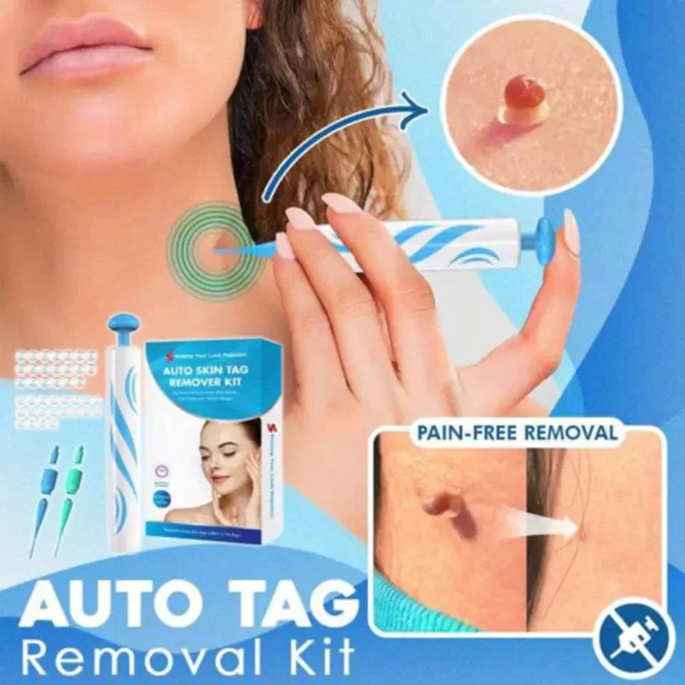 Skin Tag Removal Kit Pain-Free Auto Applicator 44 Bands