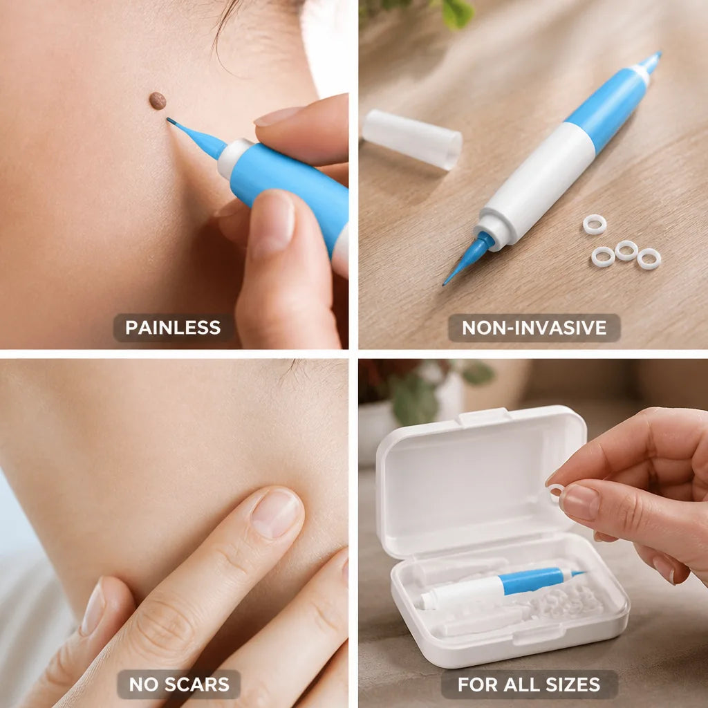 Skin Tag Removal Kit Painless Non-Invasive No Scars