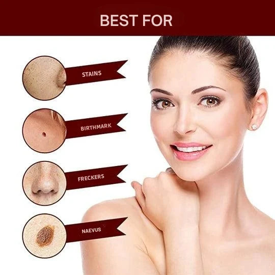 Skin Tag & Wart Remover Pen Precision Brush Tip