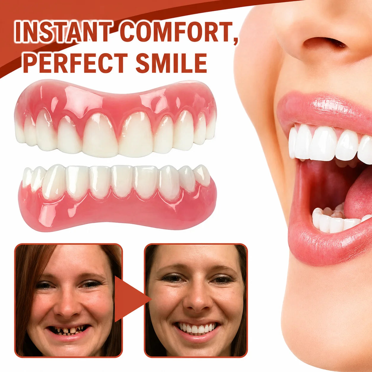 Snap-On Veneers Heat-Moldable Custom Fit Upper & Lower Set