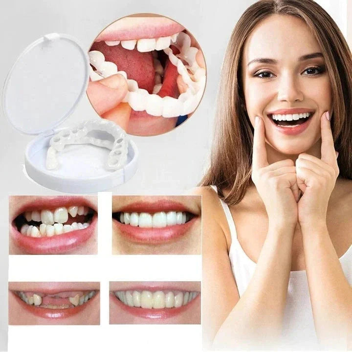 Snap-On Veneers Moldable Custom Fit Upper & Lower