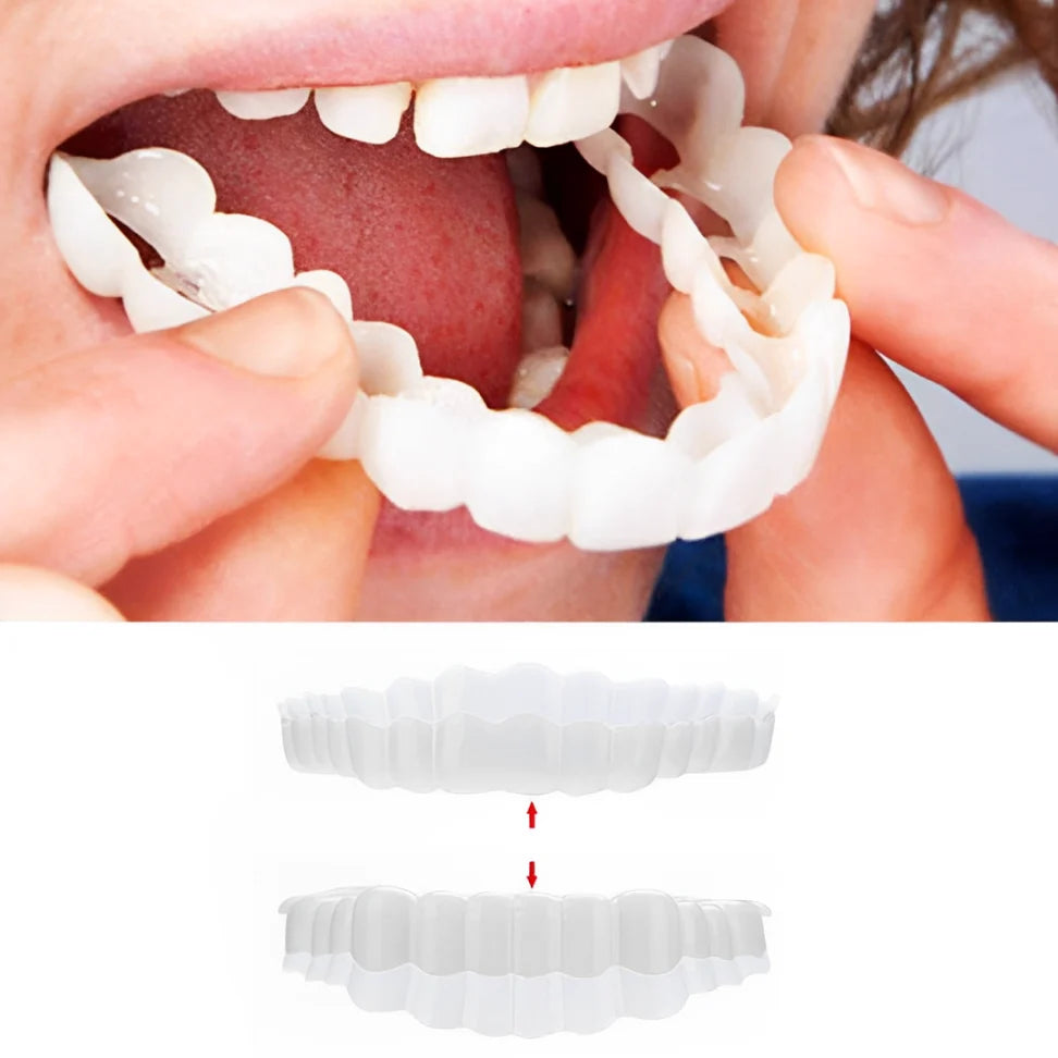 Snap-On Veneers Upper & Lower Flexible Molded Fit