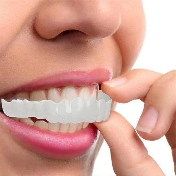 Snap-On Veneers Upper & Lower Flexible Molded Fit