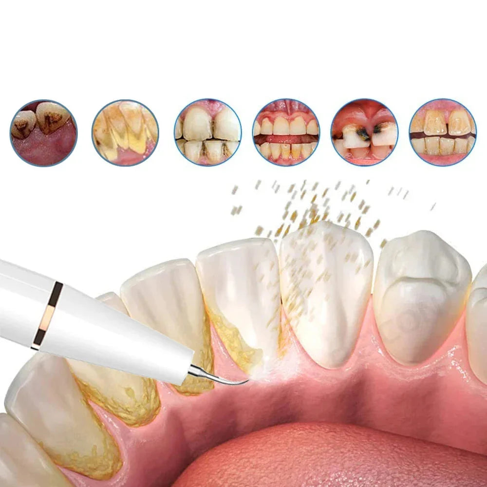 Ultrasonic Tooth Cleaner USB Rechargeable Cordless
