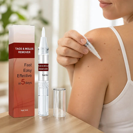 Wart Remover Pen Precision Applicator Pain-Free