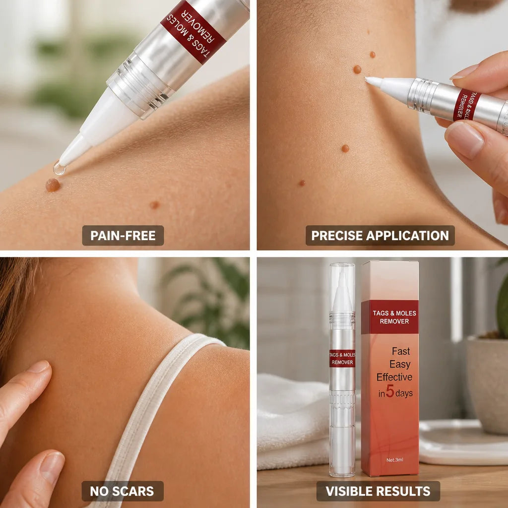 Wart Remover Pen Precision Applicator Pain-Free
